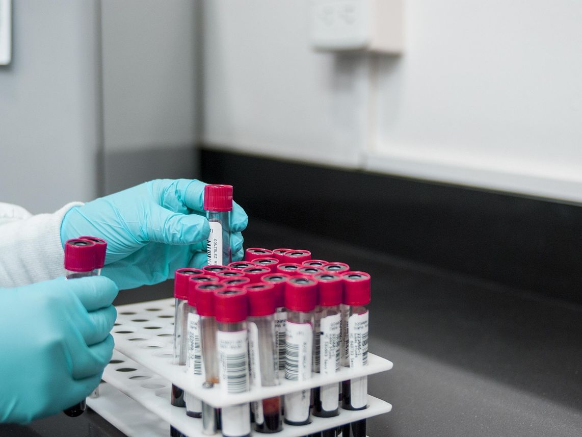 Kiedy wykonać test obciążenia glukozą w ciąży?